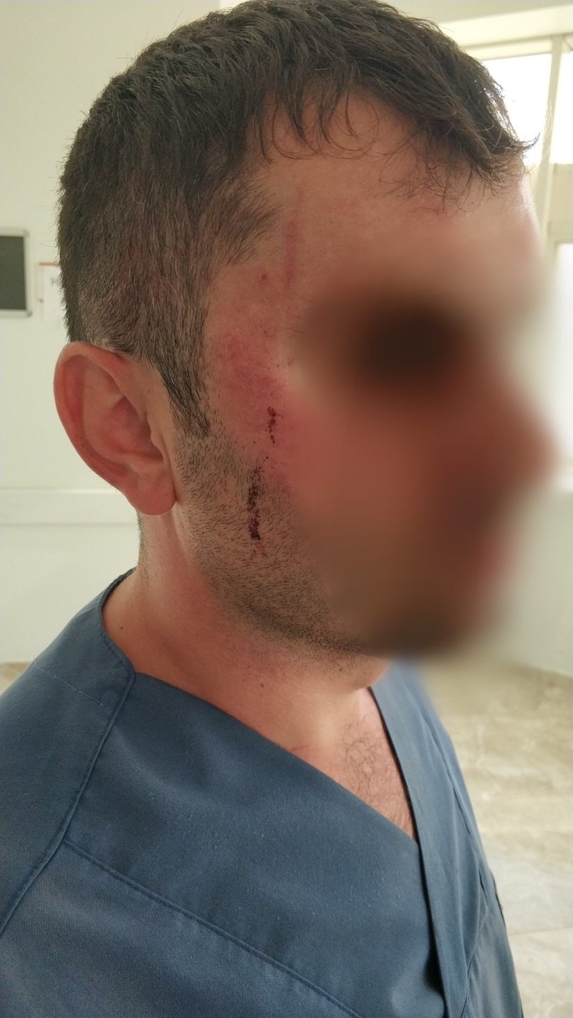 Samsun&#039;da hasta yakınları sağlık çalışanını dövdü