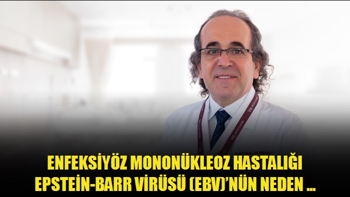 Enfeksiyöz mononükleoz hastalığı Epstein-Barr virüsü EBVnün neden olduğu öpücük hastalığının, insanlarda yaygın görülen bir enfeksiyon hastalığı o