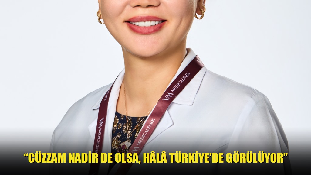 Cüzzam nadir de olsa, hl Türkiyede görülüyor